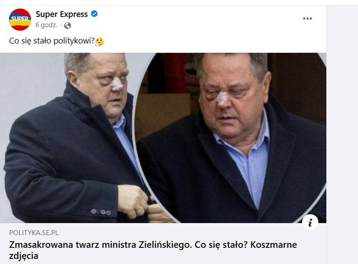 Co się stało? Niepokojące zdjęcia posła Zielińskiego w tabloidzie