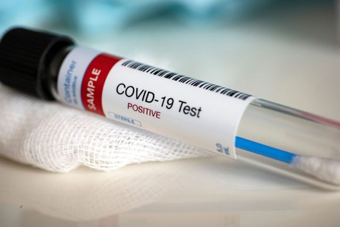 Koronawirus: 10 osób z Sejn po kontakcie z chorym urzędnikiem z Białegostoku z ujemnymi testami 