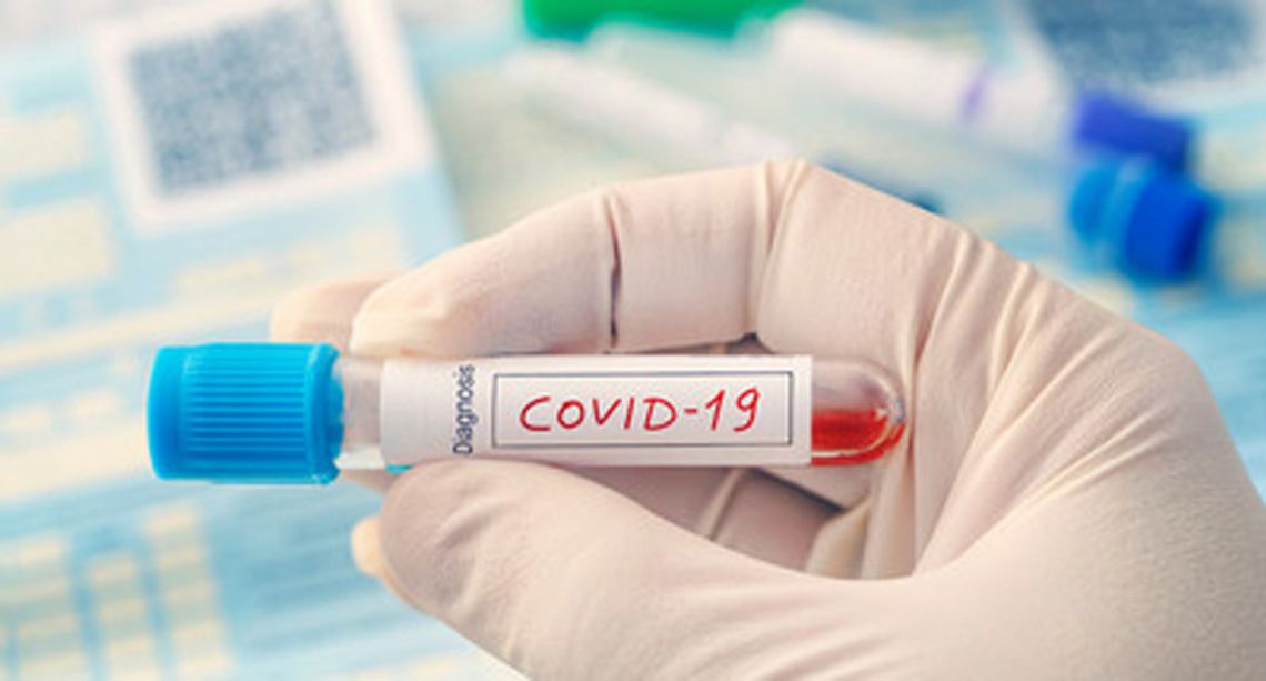 Koronawirusa w Suwałkach jeszcze nie ma, drugi test okazał się negatywny